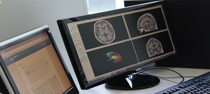 VolBrain, plataforma on line per a l'anàlisi automàtica d'imatges de ressonància magnètica del cervell