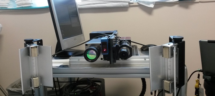 Sistema de detección temprana de melanoma basado en visión hiperespectral