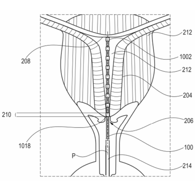 PROBES, SYSTEMS AND METHODS FOR MEASURING AND / OR CHARACTERIZING UTERINE ACTIVITY IN A NON-GESTING UTERUS